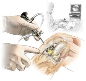 clarification of the diagnosis of arthrosis of dash medicine